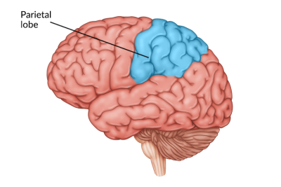 parietal-lobe-damage
