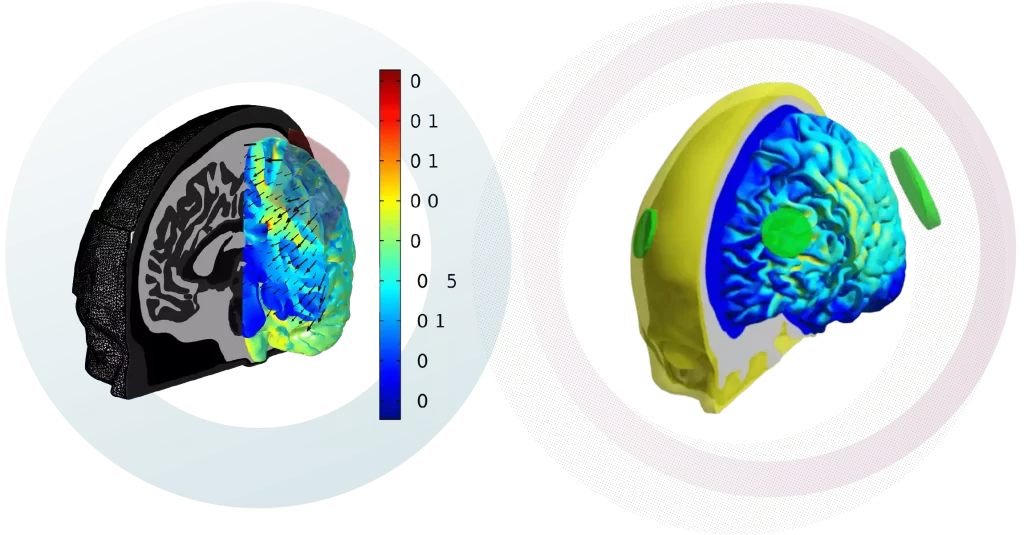NEUROELECTRICS-computational approach_01