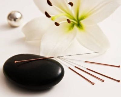 acupuncture-needles