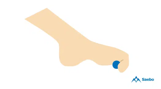body-3.png