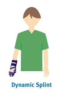 dynamic-splint.png