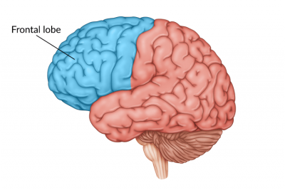 frontal-lobe-damage